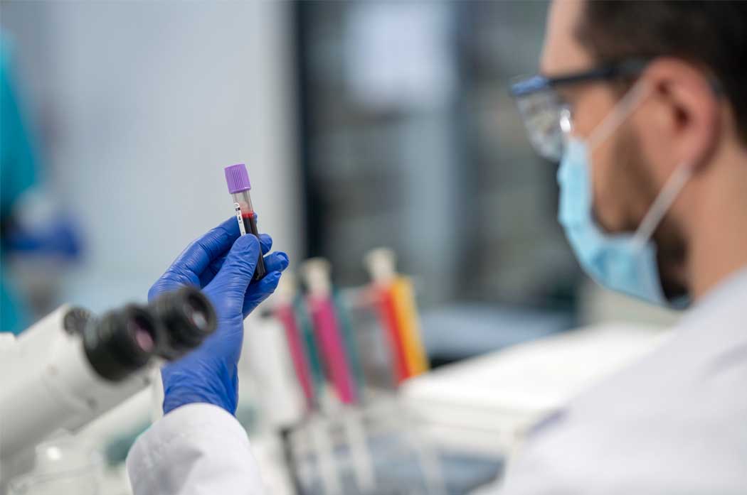 Lead Testing (Blood)